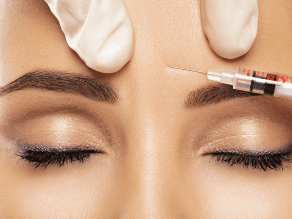 Aplicação Botox na testa