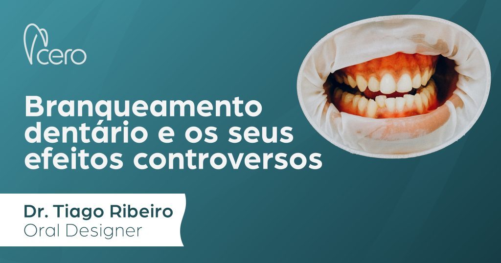 Branqueamento dentário e os seus efeitos controversos